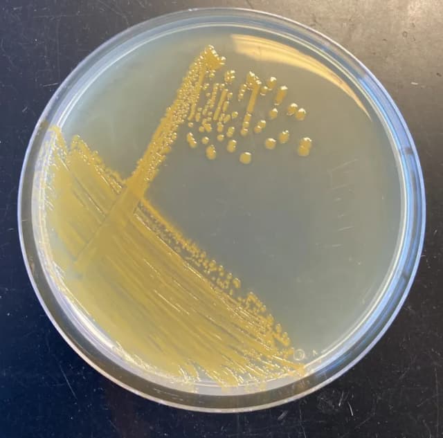 EXIGUOBACTERIUM AURANTIACUM FERMENT EXTRACT FILTRATE 대표 사진