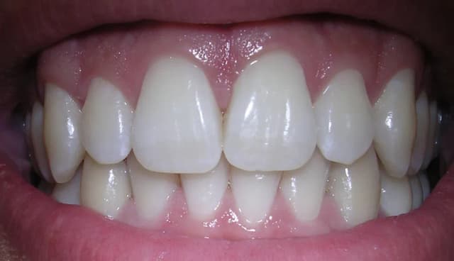 HUMAN TOOTH PULP STEM CELL EXTRACT 대표 사진