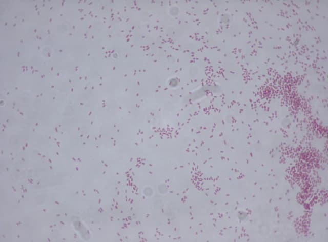 KLEBSIELLA AEROGENES FERMENT EXTRACT FILTRATE 대표 사진