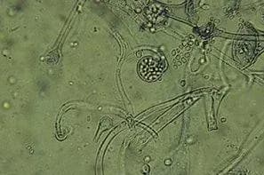 MUCOR CIRCINELLOIDES OIL 대표 사진