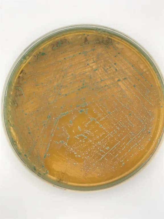 PEDIOCOCCUS ACIDILACTICI FERMENT FILTRATE EXTRACT 대표 사진