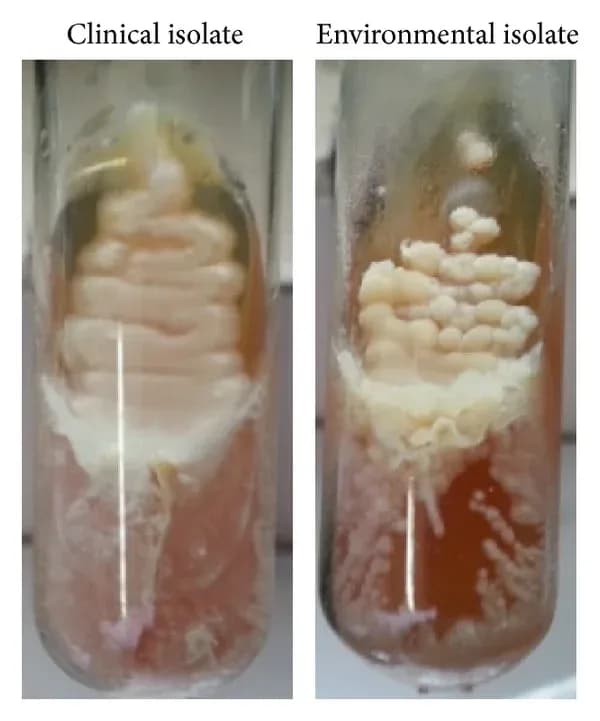 PICHIA KUDRIAVZEVII FERMENT EXTRACT FILTRATE EXTRACT/SR-(PICHIA KUDRIAVZEVII POLYPEPTIDE-1 SH-POLYPEPTIDE-181) 대표 사진