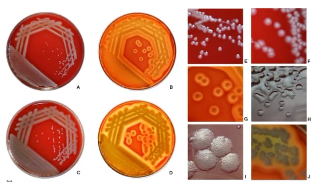 PSEUDOMONAS AERUGINOSA CULTURE CONDITIONED MEDIA EXTRACT 대표 사진