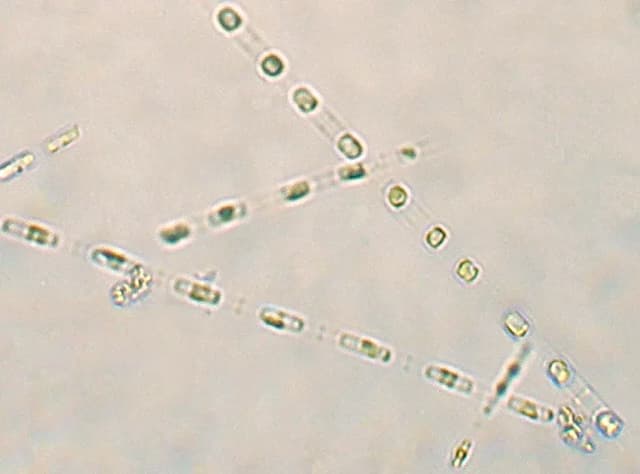 SKELETONEMA COSTATUM EXTRACT 대표 사진