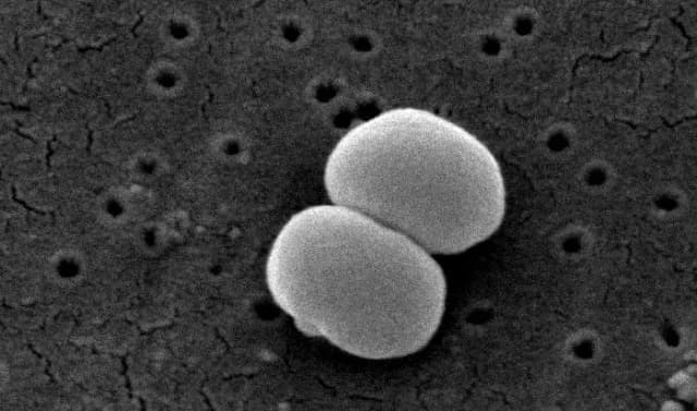 STAPHYLOCOCCUS EPIDERMIDIS LYSATE EXTRACT 대표 사진