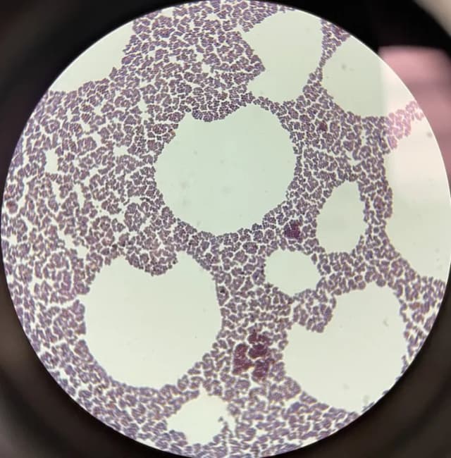 STAPHYLOCOCCUS XYLOSUS FERMENT EXTRACT FILTRATE 대표 사진