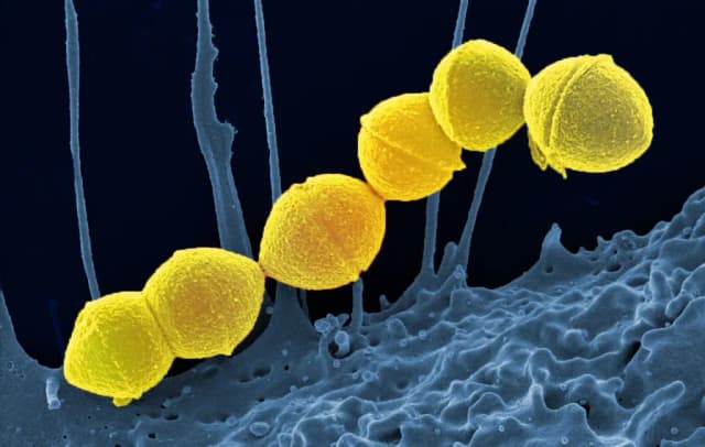 STREPTOCOCCUS PYOGENES FERMENT EXTRACT FILTRATE 대표 사진