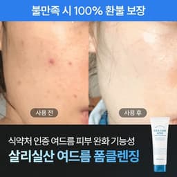 시카케어 아크네 폼클렌징